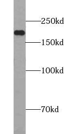 TUT4 antibody