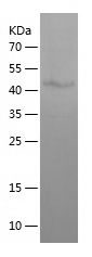 Recombinant Human ODF1