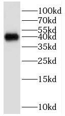 GNB5 antibody