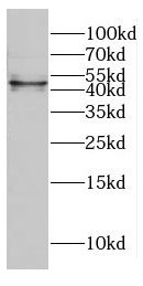 CTBP1 antibody