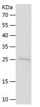 Recombinant Human TRIM69