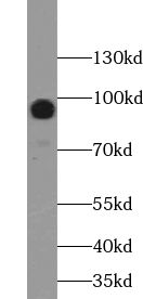 ABCB6 antibody
