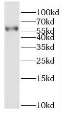 HEPACAM antibody