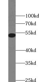 ZSCAN21 antibody
