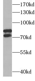 DDX17 antibody
