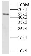 KHDRBS3 antibody