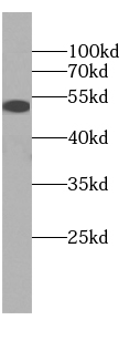 DAPK3 antibody