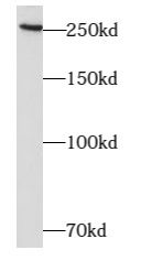 ARHGAP21 antibody
