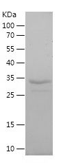 Recombinant Human SLC22A6