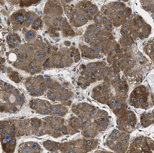 MACC1 antibody