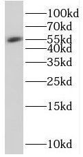 SESN3 antibody