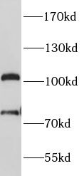 EZH2 antibody