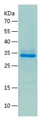 Recombinant Human GDF2