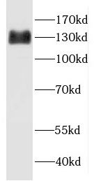 GMIP antibody