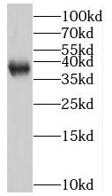 SIAH2 antibody