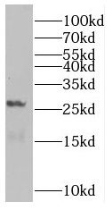 RAB5B antibody