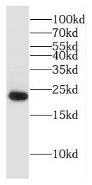 DNAJC5B antibody