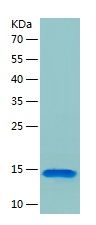 Recombinant Human CCNB1