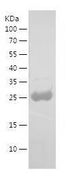 Recombinant Human gag