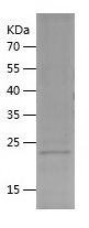 Recombinant Human CBFB