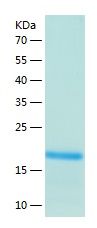 Recombinant Human TPD52L1