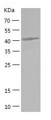 Recombinant Human ITPK1
