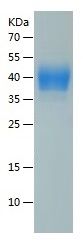 Recombinant Human TSLP R