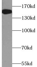 ATXN2 antibody