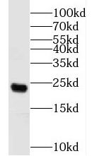 N6AMT1 antibody