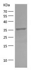 Recombinant Human FBP1