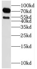 RGS9 antibody