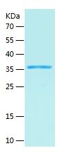 Recombinant Human SPI1