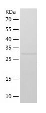 Recombinant Human SUV39H1