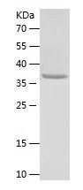 Recombinant Human TAOK1