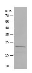 Recombinant Human GADD45GIP1