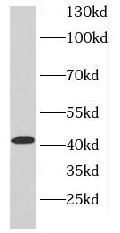 DLK2 antibody