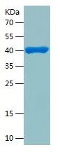 Recombinant Human MCCC2