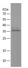 Recombinant Human PNCK