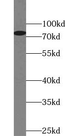 STIM1 antibody