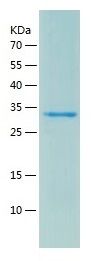 Recombinant Human CLIC5