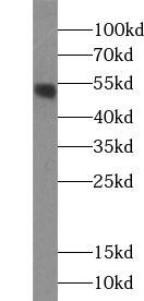 ZNF277 antibody