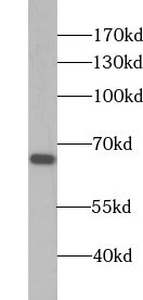 ZCCHC7 antibody