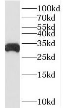 BDH1 antibody