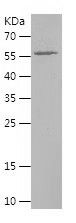 Recombinant Human ATP6V1A