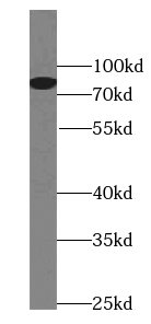 PLAA antibody