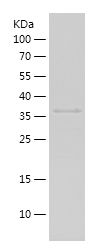 Recombinant Human RPLP0