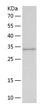 Recombinant Porcine ccl2