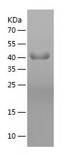 Recombinant Human CD23