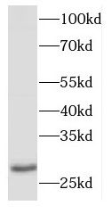 DNAJB9 antibody