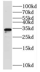 NTHL1 antibody